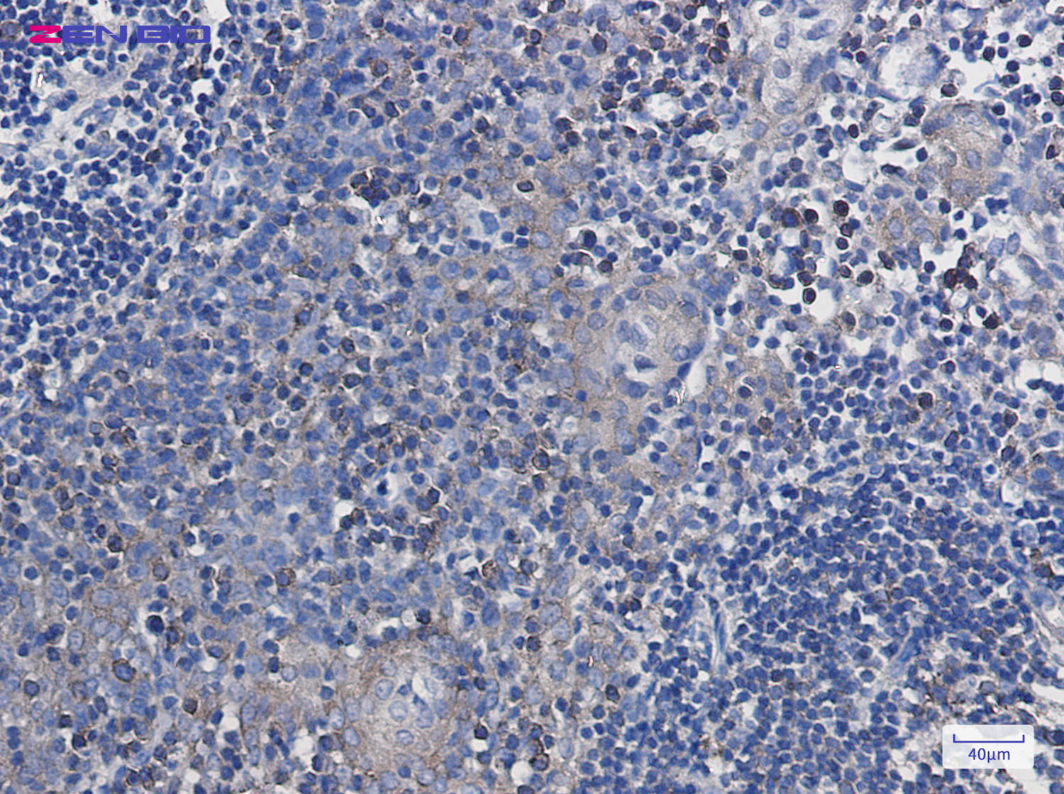 Immunohistochemistry of Annexin VII in paraffin-embedded Human tonsil using Annexin VII Rabbit pAb at dilution 1/50