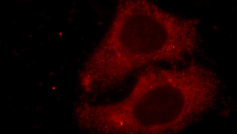Immunofluorescent analysis of HepG2 cells using Catalog No:107895(ADRP Antibody) at dilution of 1:25 and Rhodamine-Goat anti-Rabbit IgG