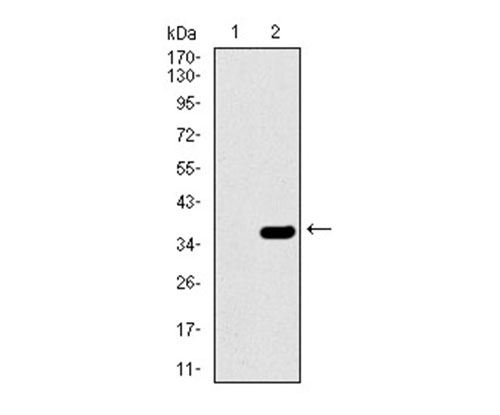 Fig2: Western blot analysis of SLC27A5 on HEK293 (1) and SLC27A5-hIgGFc transfected HEK293 (2) cell lysate using anti-SLC27A5 antibody at 1/1,000 dilution.