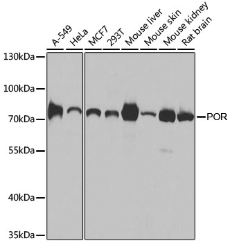 Western blot - POR Polyclonal Antibody 