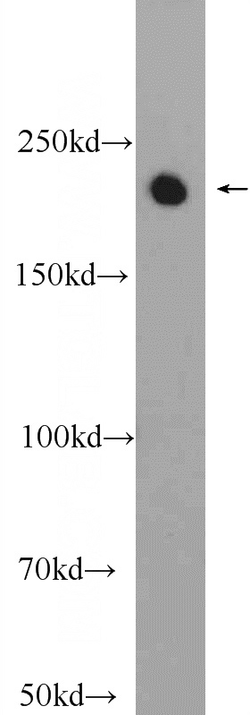 mouse brain tissue were subjected to SDS PAGE followed by western blot with Catalog No:115237(SIPA1L1 Antibody) at dilution of 1:1500