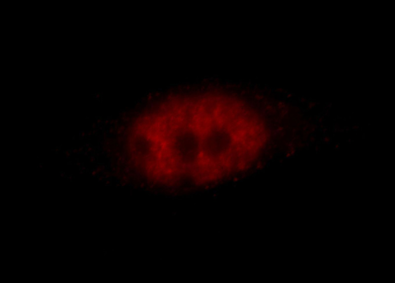 Immunofluorescent analysis of Hela cells, using ZBTB7B antibody Catalog No:116920 at 1:25 dilution and Rhodamine-labeled goat anti-rabbit IgG (red).