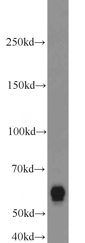 mouse testis tissue were subjected to SDS PAGE followed by western blot with Catalog No:114677(RECQL5 antibody) at dilution of 1:1000