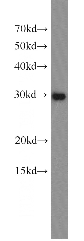 HeLa cells were subjected to SDS PAGE followed by western blot with Catalog No:115570(SPIN1 antibody) at dilution of 1:800