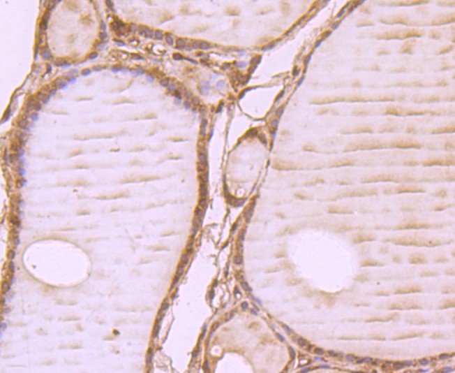 Fig4: Immunohistochemical analysis of paraffin-embedded human thyroid tissue using anti-WSCD2 antibody. Counter stained with