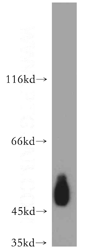 Jurkat cells were subjected to SDS PAGE followed by western blot with Catalog No:109127(CD47 antibody) at dilution of 1:500