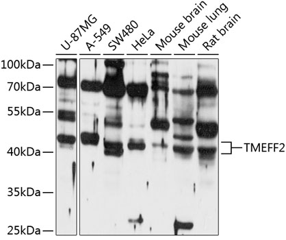 Western blot - TMEFF2 Polyclonal Antibody 