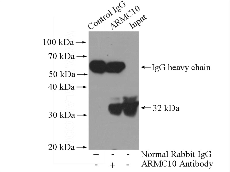 IP Result of anti-ARMC10 (IP:Catalog No:108148, 4ug; Detection:Catalog No:108148 1:500) with A431 cells lysate 1600ug.