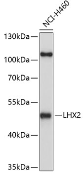 Western blot - LHX2 Polyclonal Antibody 