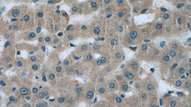 Immunohistochemistry of paraffin-embedded human liver tissue slide using Catalog No:109446(CFB Antibody) at dilution of 1:50 (under 40x lens)