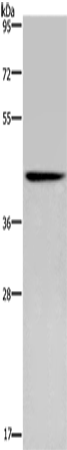 Gel: 8%SDS-PAGE, Lysate: 40 μg, Lane: Human fetal brain tissue, Primary antibody: 166813(CERS5 Antibody) at dilution 1/350, Secondary antibody: Goat anti rabbit IgG at 1/8000 dilution, Exposure time: 5 minutes