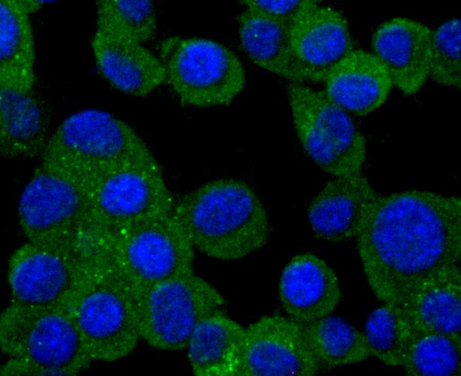 Fig2:; ICC staining of PMP22 in N2A cells (green). Formalin fixed cells were permeabilized with 0.1% Triton X-100 in TBS for 10 minutes at room temperature and blocked with 1% Blocker BSA for 15 minutes at room temperature. Cells were probed with the primary antibody ( 1/50) for 1 hour at room temperature, washed with PBS. Alexa Fluor®488 Goat anti-Rabbit IgG was used as the secondary antibody at 1/1,000 dilution. The nuclear counter stain is DAPI (blue).
