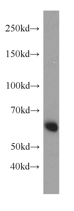 HEK-293 cells were subjected to SDS PAGE followed by western blot with Catalog No:113557(SQSTM1 antibody) at dilution of 1:1000