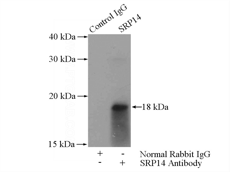 IP Result of anti-SRP14 (IP:Catalog No:115590, 4ug; Detection:Catalog No:115590 1:300) with A549 cells lysate 1600ug.
