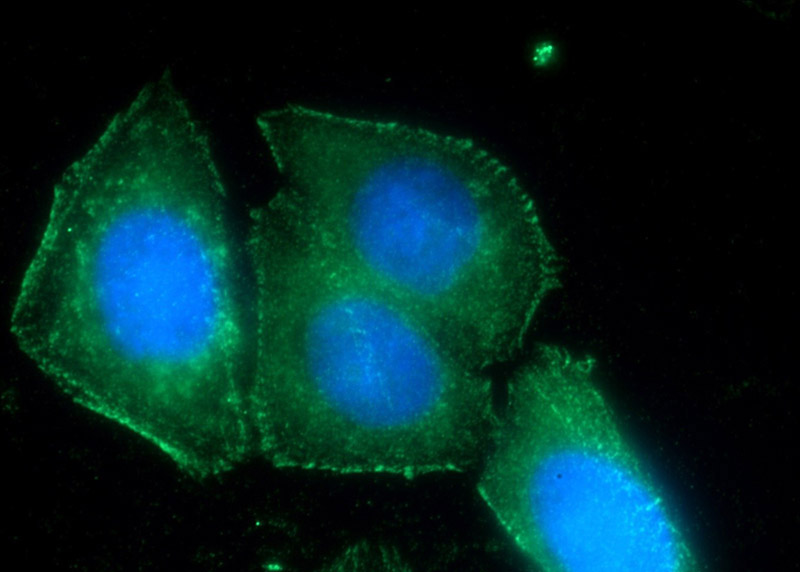Immunofluorescent analysis of HepG2 cells using Catalog No:110601(FAM78A Antibody) at dilution of 1:50 and Alexa Fluor 488-congugated AffiniPure Goat Anti-Rabbit IgG(H+L)