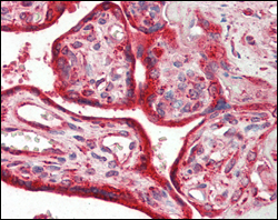 Immunohistochemical analysis of paraffin-embedded human placenta tissues using Calreticulin mouse mAb.