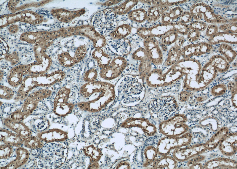 Immunohistochemical of paraffin-embedded human kidney using Catalog No:110785(FTCD antibody) at dilution of 1:50 (under 10x lens)