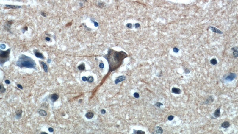 Immunohistochemical of paraffin-embedded human brain using Catalog No:114094(PPP1R9B antibody) at dilution of 1:50 (under 40x lens)