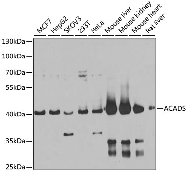 Western blot - ACADS Polyclonal Antibody 