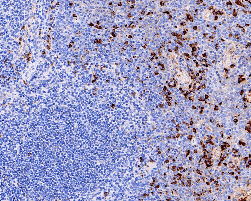 Fig3:; Immunohistochemical analysis of paraffin-embedded human tonsil tissue using anti-IgA antibody. The section was pre-treated using heat mediated antigen retrieval with Tris-EDTA buffer (pH 8.0-8.4) for 20 minutes.The tissues were blocked in 5% BSA for 30 minutes at room temperature, washed with ddH; 2; O and PBS, and then probed with the primary antibody ( 1/200) for 30 minutes at room temperature. The detection was performed using an HRP conjugated compact polymer system. DAB was used as the chromogen. Tissues were counterstained with hematoxylin and mounted with DPX.