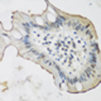 Immunohistochemistry - ALOX15 Polyclonal Antibody 