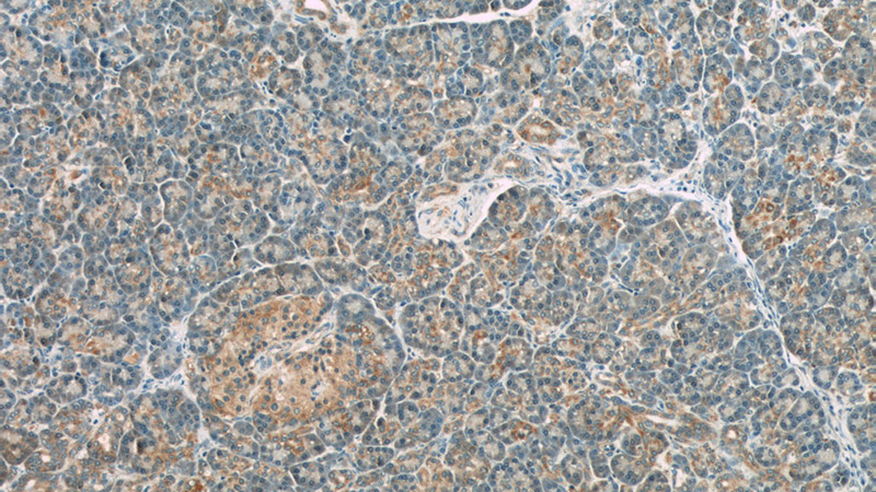 Immunohistochemistry of paraffin-embedded human pancreas slide using Catalog No:113718(PERK Antibody) at dilution of 1:50