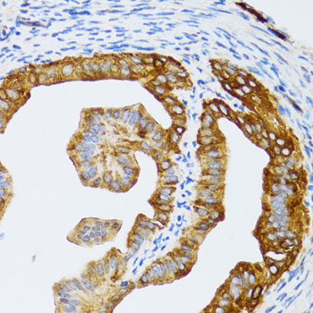 Immunohistochemistry - CHAF1B Polyclonal Antibody 