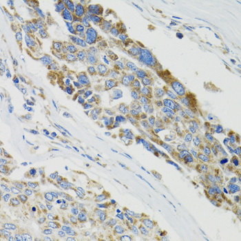 Immunohistochemistry - SH2B1 Polyclonal Antibody 