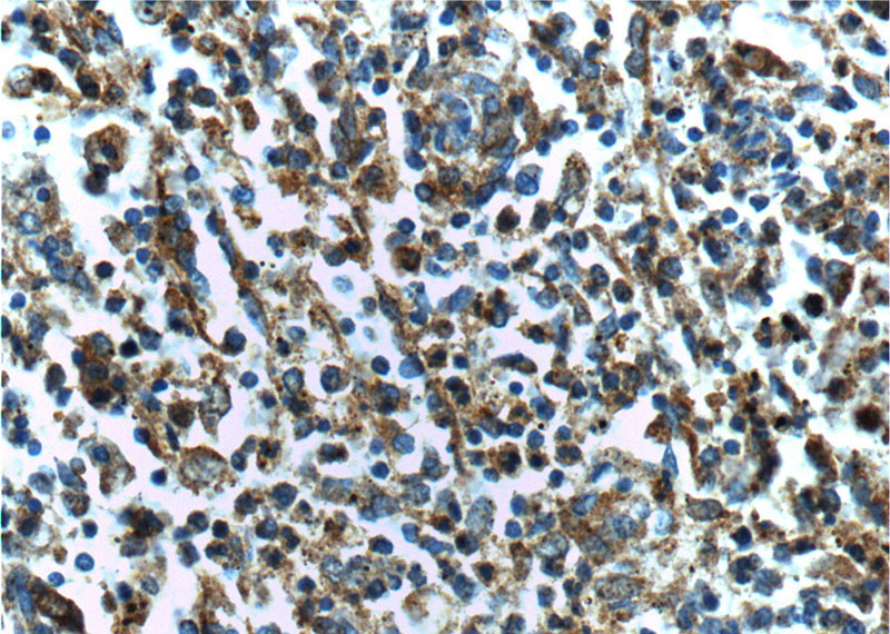 Immunohistochemistry of paraffin-embedded human spleen tissue slide using Catalog No:117126(Beta Arrestin 2 Antibody) at dilution of 1:200 (under 40x lens).