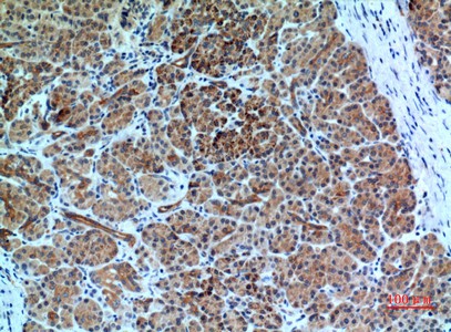 Fig2:; Immunohistochemical analysis of paraffin-embedded human-pancreas, antibody was diluted at 1:100