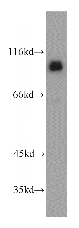 mouse brain tissue were subjected to SDS PAGE followed by western blot with Catalog No:109747(CUL4B antibody) at dilution of 1:800