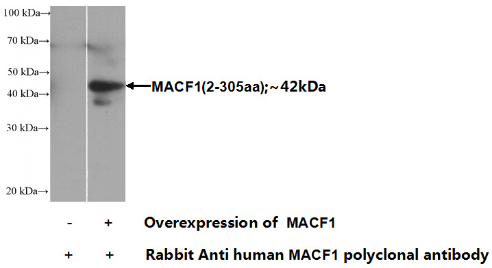 Transfected HEK-293 cells were subjected to SDS PAGE followed by western blot with Catalog No:112365(MACF1 Antibody) at dilution of 1:1000