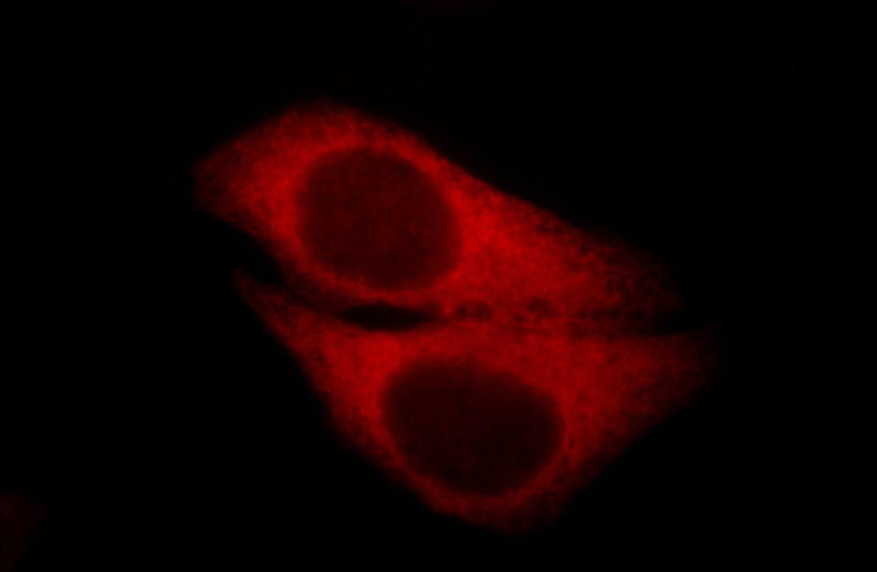 Immunofluorescent analysis of HepG2 cells, using HSP90AB1 antibody Catalog No:111571 at 1:25 dilution and Rhodamine-labeled goat anti-rabbit IgG (red).