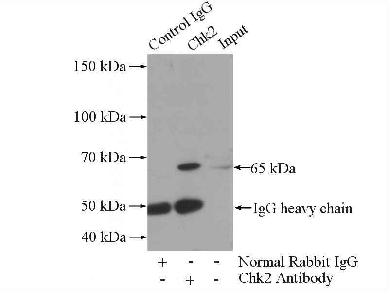 IP Result of anti-CHEK2 (IP:Catalog No:109229, 4ug; Detection:Catalog No:109229 1:500) with HL-60 cells lysate 1600ug.