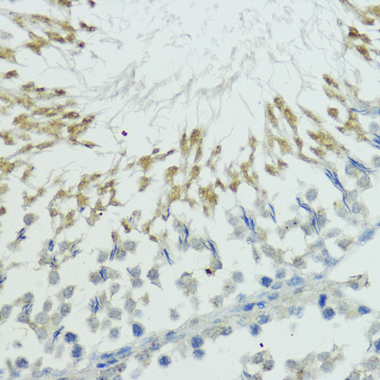 Immunohistochemistry - TRIP12 Polyclonal Antibody 