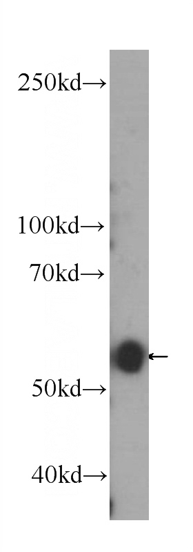 Jurkat cells were subjected to SDS PAGE followed by western blot with Catalog No:107253(ENTPD1 Antibody) at dilution of 1:500