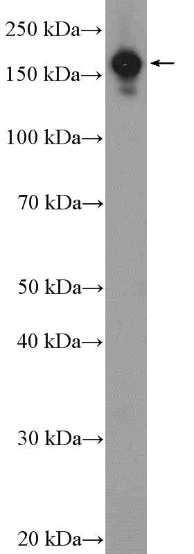 HEK-293 cells were subjected to SDS PAGE followed by western blot with Catalog No:110190(EIF3A Antibody) at dilution of 1:600