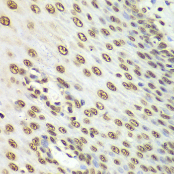 Immunohistochemistry - NONO Polyclonal Antibody 