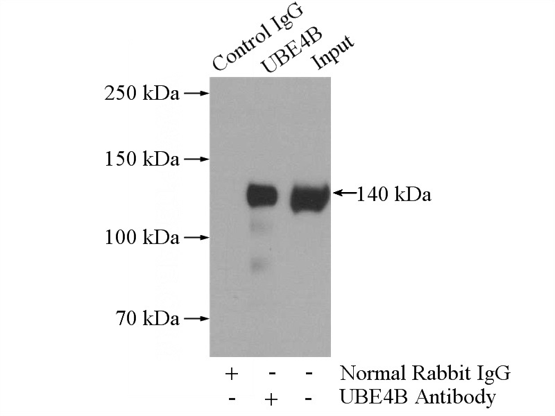 IP Result of anti-UBE4B (IP:Catalog No:116544, 4ug; Detection:Catalog No:116544 1:2000) with HeLa cells lysate 1200ug.
