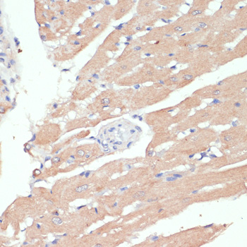 Immunohistochemistry - WNT5B Polyclonal Antibody 