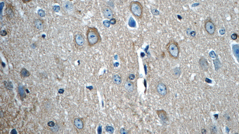 Immunohistochemistry of paraffin-embedded mouse brain tissue slide using Catalog No:107658(14-3-3 Antibody) at dilution of 1:50 (under 40x lens)