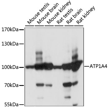 Western blot - ATP1A4 Polyclonal Antibody 