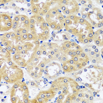 Immunohistochemistry - CCDC124 Polyclonal Antibody 