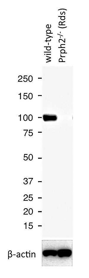 WB results of PDE6B antibody (Catalog No:113666) with WT mouse Eye and Prph2 (Rds) mutant mouse Eye (Negative control). Courtesy of Seongjin Seo, PhD, University of Iowa College of Medicine.