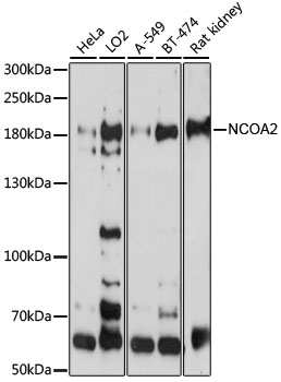Western blot - NCOA2 Polyclonal Antibody 