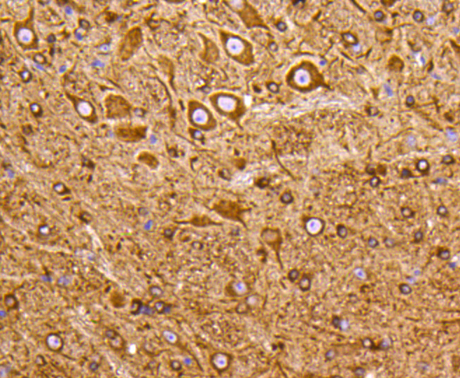 Immunohistochemistry - PIK3R3 Monoclonal Antibody 