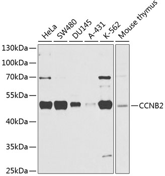 Western blot - CCNB2 Polyclonal Antibody 