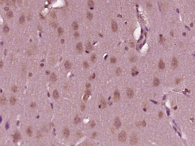 Fig2: Paraformaldehyde-fixed, paraffin embedded (rat brain tissue); Antigen retrieval by boiling in sodium citrate buffer (pH6.0) for 15min; Block endogenous peroxidase by 3% hydrogen peroxide for 20 minutes; Blocking buffer (normal goat serum) at 37℃ for 30min; Antibody incubation with (CENPL) Polyclonal Antibody, Unconjugated at 1:400 overnight at 4℃, followed by operating according to SP Kit(Rabbit) (sp-0023) instructionsand DAB staining.