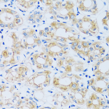 Immunohistochemistry - ARPC1A Polyclonal Antibody 