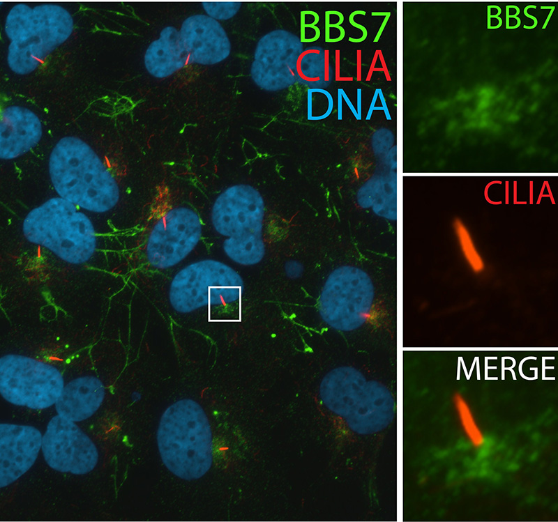 IF result (pericentriolar staining) of anti-BBS7 (Catalog No:108374, 1:50) with serum-starved hTERT-RPE1 by Dr. Moshe Kim.